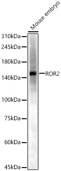 ROR2 Polyclonal Antibody