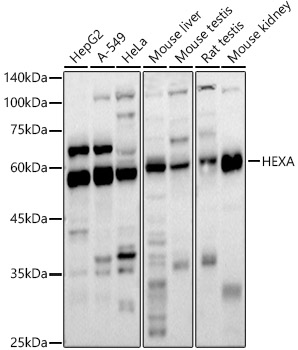 HEXA Polyclonal Antibody