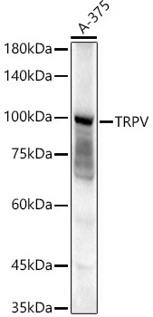 TRPV4 Polyclonal Antibody
