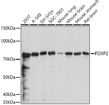 FOXP2 Polyclonal Antibody