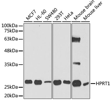 HPRT1 Polyclonal Antibody