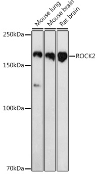 ROCK2 Polyclonal Antibody
