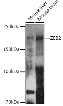 ZEB2 Polyclonal Antibody