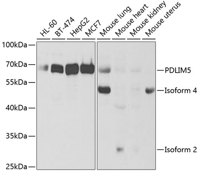 PDLIM5 Polyclonal Antibody