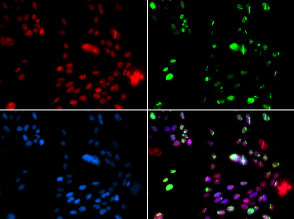 PIAS1 Polyclonal Antibody