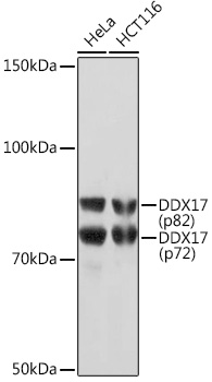 DDX17 Monoclonal Antibody [2U1P0]