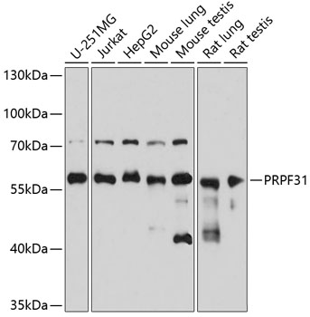 PRPF31 Polyclonal Antibody