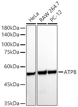ATPB Polyclonal Antibody