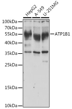 ATP1B1 Polyclonal Antibody