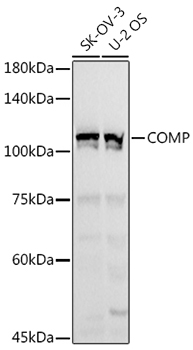 COMP Polyclonal Antibody