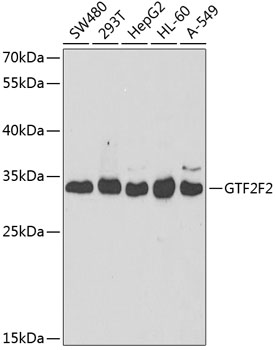 GTF2F2 Polyclonal Antibody