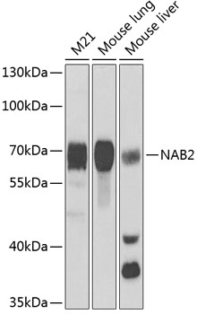 NAB2 Polyclonal Antibody