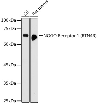 NOGO Receptor 1 (RTN4R) Polyclonal Antibody