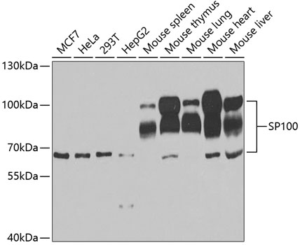 SP100 Polyclonal Antibody