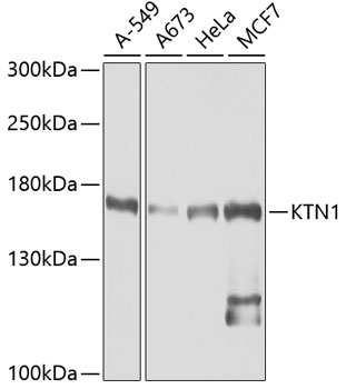 KTN1 Polyclonal Antibody