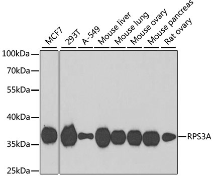 RPS3A Polyclonal Antibody