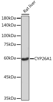 CYP26A1 Monoclonal Antibody [1E1D2]