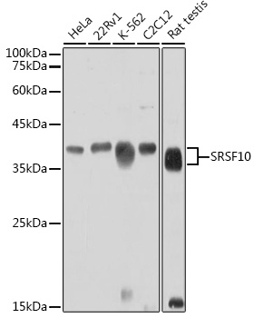 SRSF10 Polyclonal Antibody