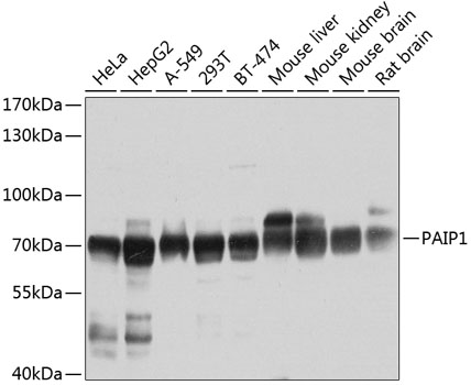 PAIP1 Polyclonal Antibody
