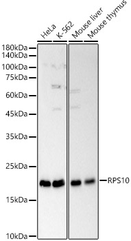 RPS10 Polyclonal Antibody