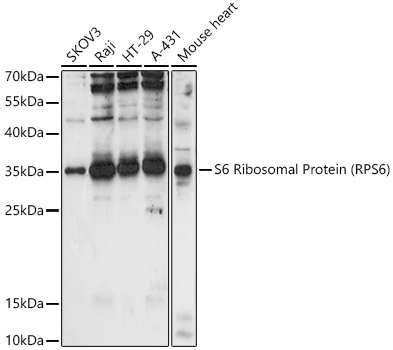 S6 Ribosomal Protein (RPS6) Polyclonal Antibody