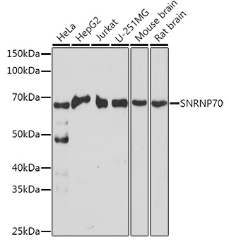 SNRNP70 Polyclonal Antibody
