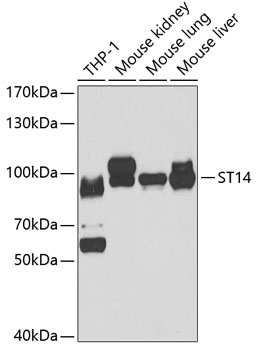 ST14 Polyclonal Antibody