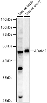 ADAM5 Polyclonal Antibody&nbsp;<img src="images/icon_newarrival.gif" alt="new" border="0">