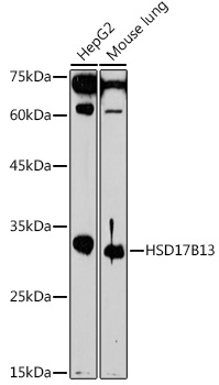 HSD17B13 Polyclonal Antibody