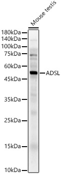 ADSL Polyclonal Antibody&nbsp;<img src="images/icon_newarrival.gif" alt="new" border="0">