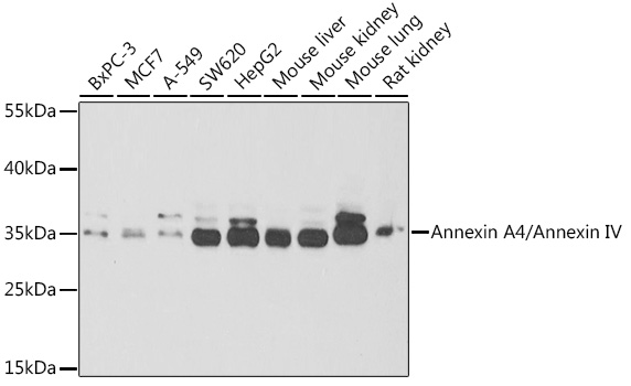 Annexin A4/Annexin IV Polyclonal Antibody