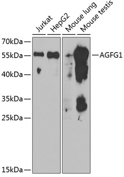 AGFG1 Polyclonal Antibody&nbsp;<img src="images/icon_newarrival.gif" alt="new" border="0">