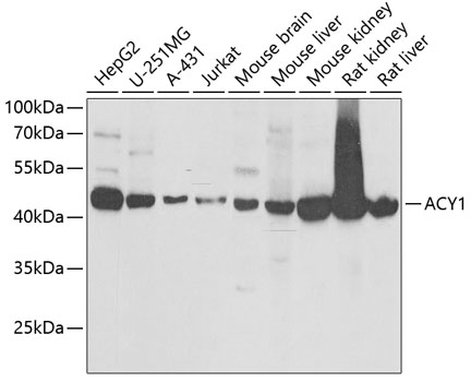 ACY1 Polyclonal Antibody&nbsp;<img src="images/icon_newarrival.gif" alt="new" border="0">