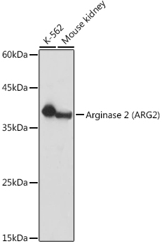 Arginase 2 (ARG2) Polyclonal Antibody
