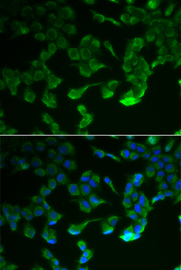 C1R Polyclonal Antibody