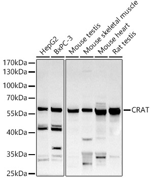CRAT Polyclonal Antibody