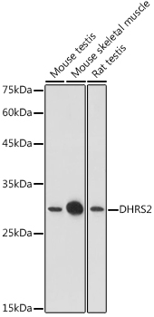 DHRS2 Polyclonal Antibody