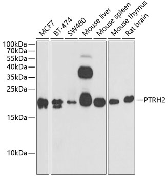 PTRH2 Polyclonal Antibody