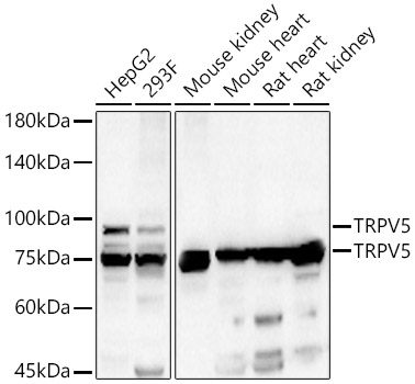 TRPV5 Polyclonal Antibody