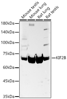 KIF2B Polyclonal Antibody