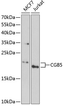 CGB5 Polyclonal Antibody