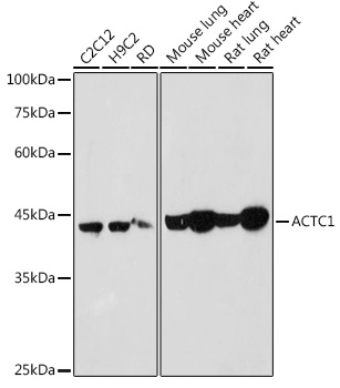 ACTC1 Polyclonal Antibody&nbsp;<img src="images/icon_newarrival.gif" alt="new" border="0">