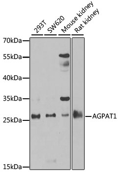 AGPAT1 Polyclonal Antibody&nbsp;<img src="images/icon_newarrival.gif" alt="new" border="0">