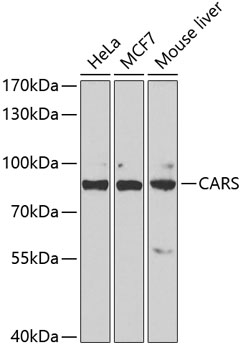 CARS Polyclonal Antibody