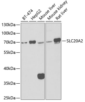 SLC20A2 Polyclonal Antibody