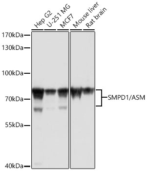 SMPD1 / ASM Polyclonal Antibody