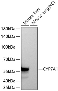 CYP7A1 Monoclonal Antibody [10S1C5]