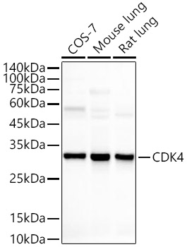 CDK4 Monoclonal Antibody [6N3M6]