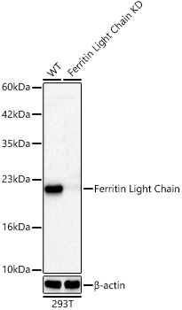 Ferritin Light Chain Monoclonal Antibody [4T7Z7]&nbsp;<img src="images/icon_newarrival.gif" alt="new" border="0">