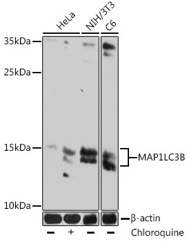 LC3B Monoclonal Antibody [10M5H10]
